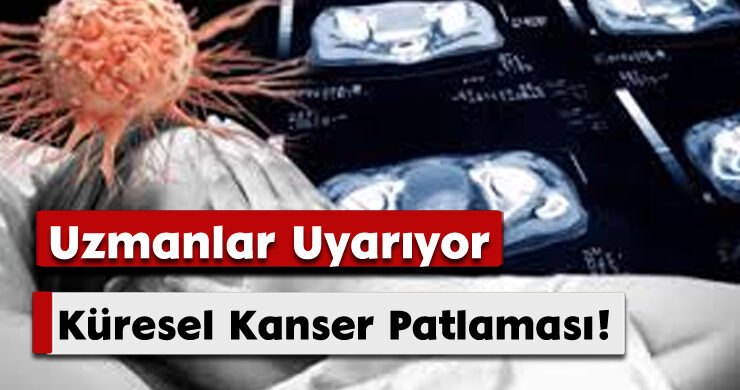 Uzmanlar Uyarıyor: Küresel Kanser Patlaması!