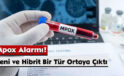 İngiltere’de Mpox Alarmı! Yeni ve Hibrit Bir Tür Ortaya Çıktı